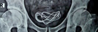 Charging The Urethra